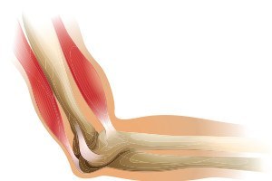 Diagram of a human elbow