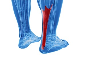 Rendering of human achilles tendon